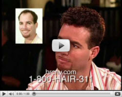 Men's Hair Replacement Videos New York